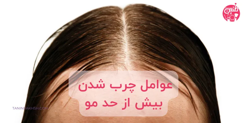 علت های چرب شدن مو